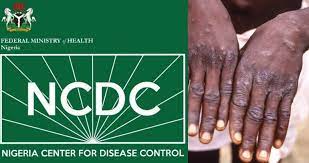  Monkeypox: Nigeria Reports Six Cases, One Death